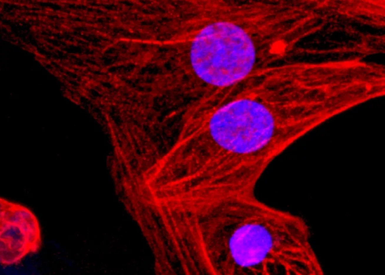 Human-heart-muscle-TSI